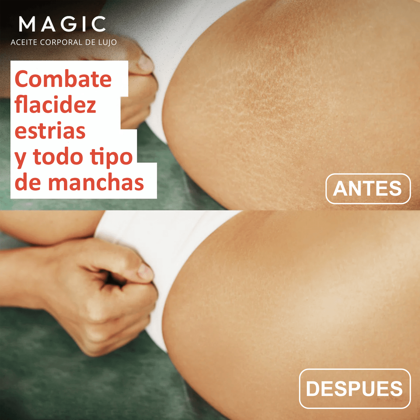 Aceite Original Corporal Magic™
