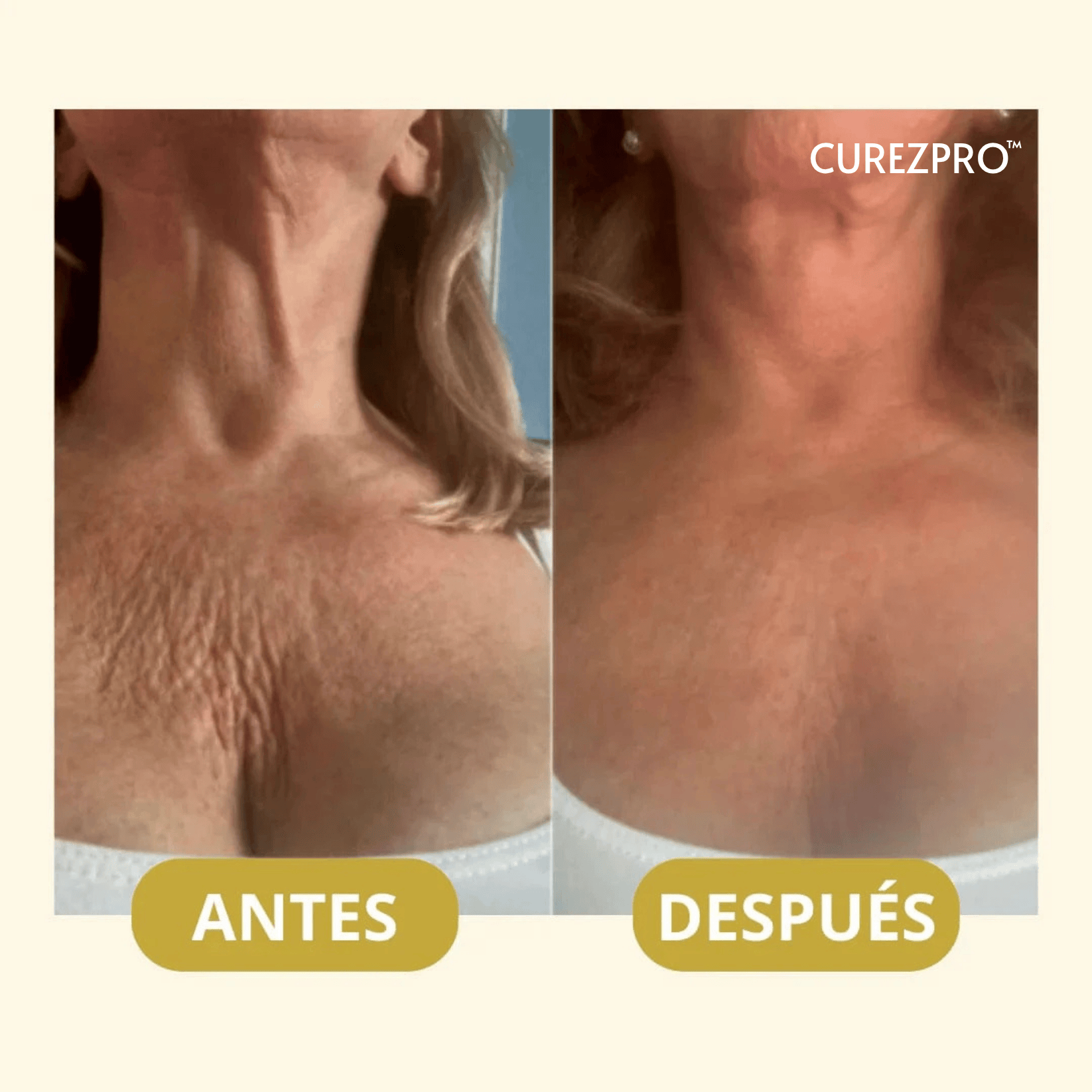Curezpro® Aceite Corporal Elixir