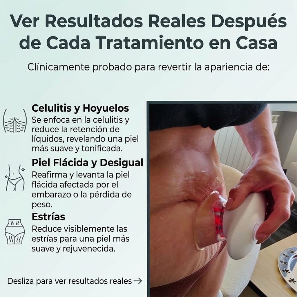 Tonifica y reafirma tu piel en tan solo 15 minutos al día desde casa. Sin dolor y clínicamente probado.